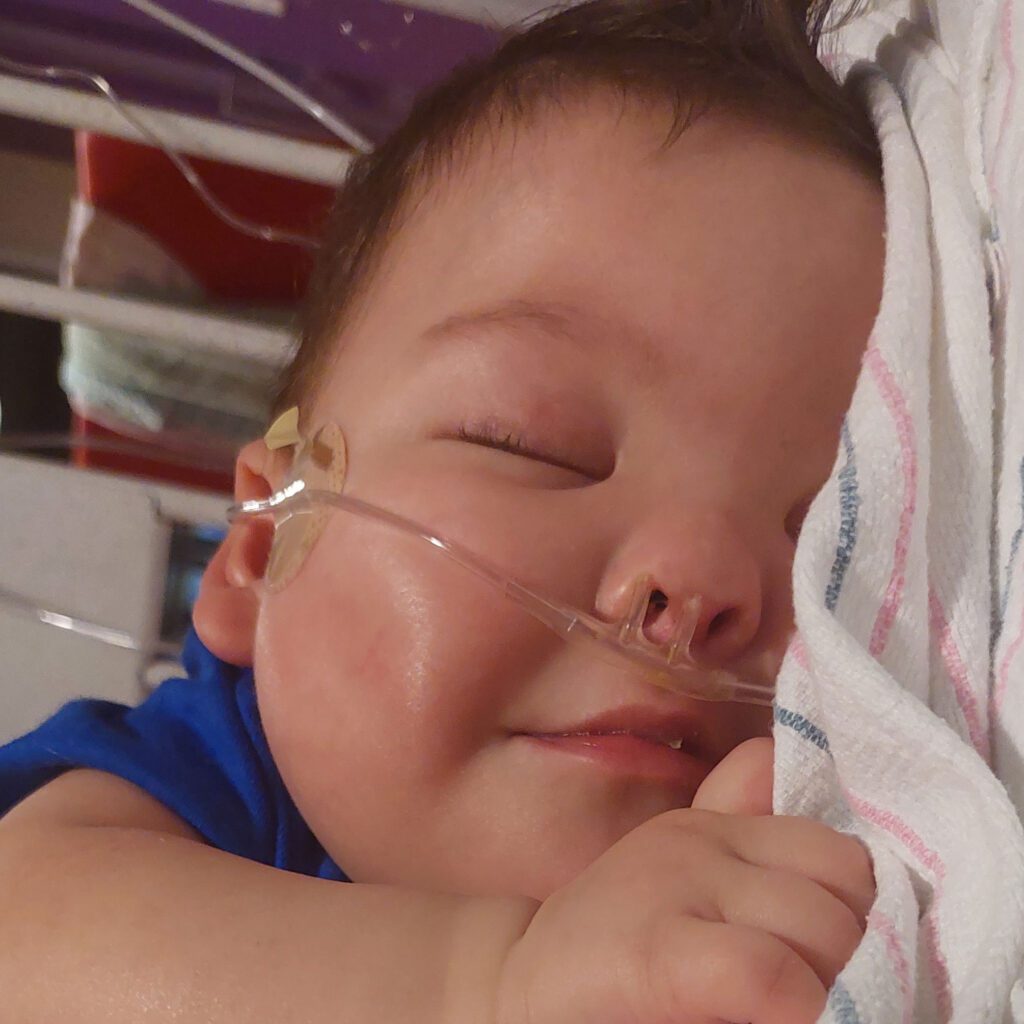 Infant Joy smiles in her sleep. She has an oxygen tube coming out of her nose.