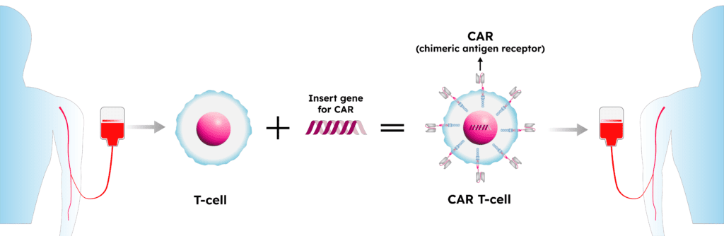 An illustration of the process of removing T cells from a patient's body, genetically modifying them in a lab, and infusing them back into the patient's body